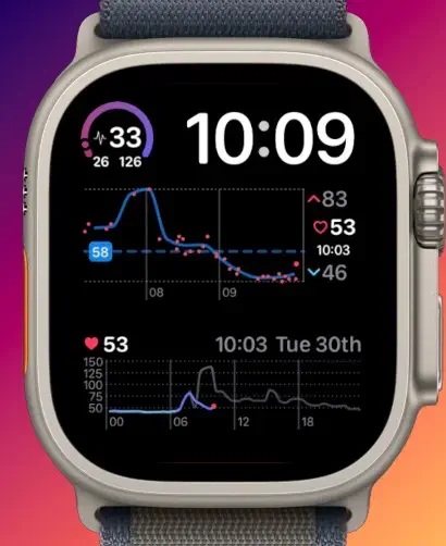 Heart Analyzer on Apple Watch showing heart rate history, daily readings and an HRV complication
