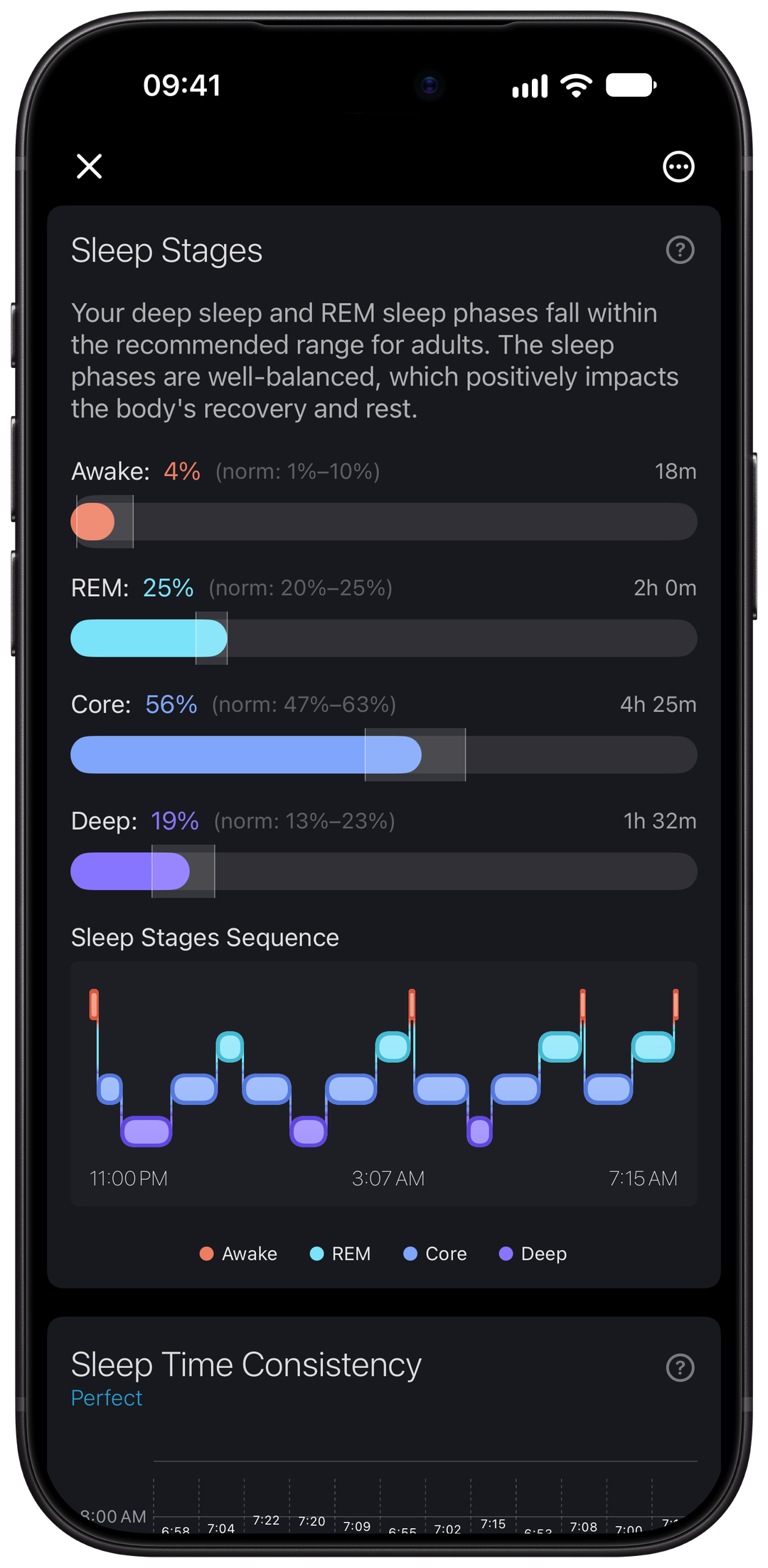 Sleep Stages with each stage’s duration and the overnight sequence