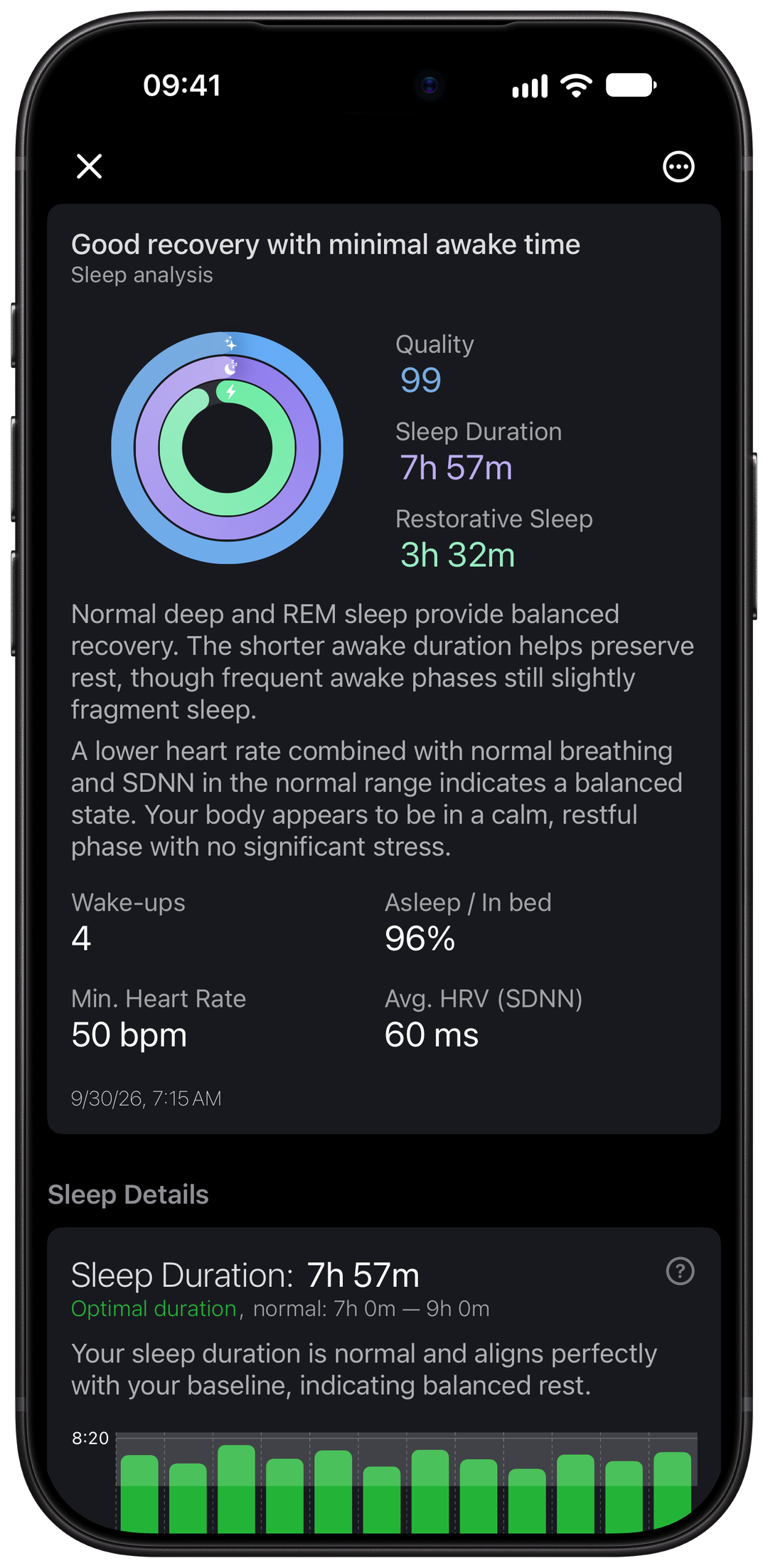 Sleep summary and duration