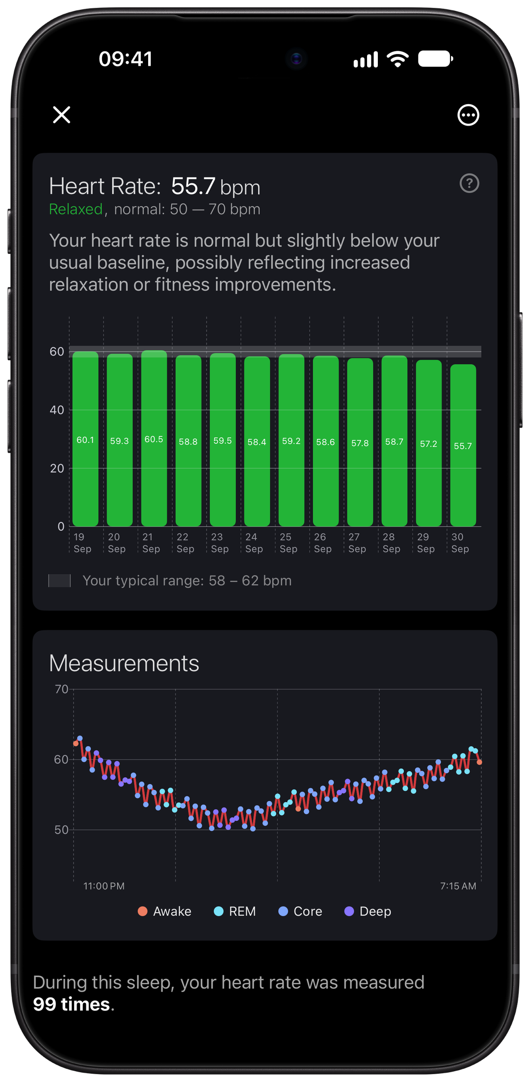 Overnight heart rate history and measurements colored by sleep stage