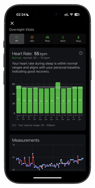 Apple Watch Vitals decoded