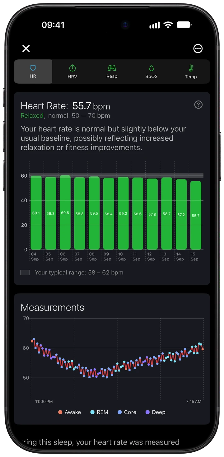 Wellhero overnight heart rate tab with nightly average, history and readings colored by sleep stage